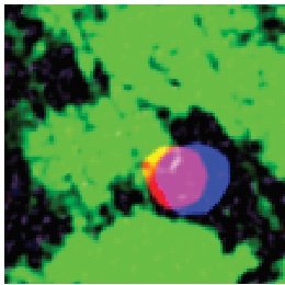 Physician-scientist with an interest in airway epithelial biology, mucin granule transport, and autophagy