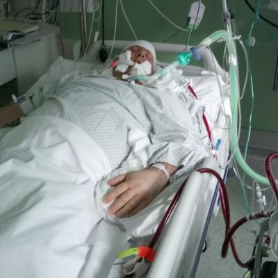 Coma & ARDS survivor after spending 4 weeks on life support in 2017. All credit to LKH- Uni Klinikum Graz, Austria.