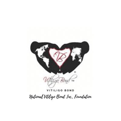 Vitiligo Bond Foundation is an awareness, empowerment and support org for youth & adults coping with vitiligo. https://t.co/W39Cbes8Cj