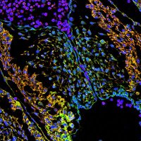 Tybulewicz Lab (@tybulewiczlab) 's Twitter Profile Photo Tybulewicz Lab (@tybulewiczlab) 's Twitter Profile Photo