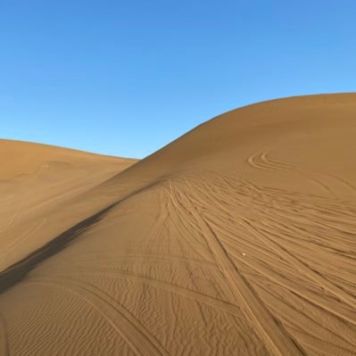 fjxsc123456's profile picture. has had type 1 diabetes mellitus for 10 years and has no complications at present.  uses the DIY closed-loop system to control blood sugar