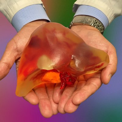 Moffitt Hepatobiliary Profile