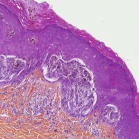 Dermatopathologie 🇫🇷 (@dermatopathfr) 's Twitter Profile Photo