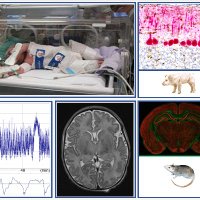 Translational Neuroscience & Hypothermia Team (@translationaln1) 's Twitter Profile Photo Translational Neuroscience & Hypothermia Team (@translationaln1) 's Twitter Profile Photo