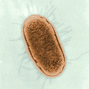 Gram negative, rod-shaped bacterium found in the lower gut of warm-blooded animals. Bad if I'm a foreign strain to yours. Wash your vegs and cook your food.