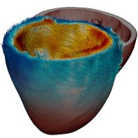 Royal Brompton CMR Physics Group (@rbhcmrphysics) 's Twitter Profile Photo Royal Brompton CMR Physics Group (@rbhcmrphysics) 's Twitter Profile Photo