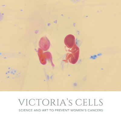 Victoria’s Cells