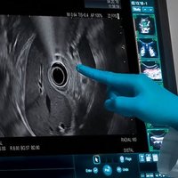 EUS & ERCP Master (@giscope_updates) 's Twitter Profile
