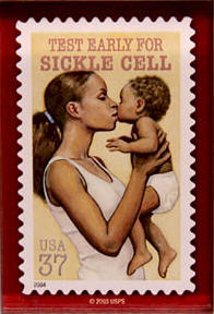 Help us raise awareness for sickle cell anemia.  As part of a project we will be fundraising money to donate to the Lubbock Sickle Cell Ministries.