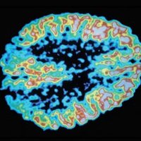 Neurometabolism (@neurometabolis1) 's Twitter Profile