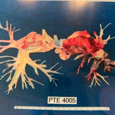 SarcomaNinja's profile picture. Wife, Patient Advocate, Proud Mama Bear, All Things Sarcoma