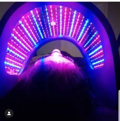 laser hair removal Blackburn #Burnley #Nelson #Brierfeild #Preston Lumenis lightsheer. #Full Face £60 Full Legs £180 #Underarms £60 #UpperLip £15