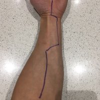 liverpoolhandsurgery (@cheunggraham) 's Twitter Profile
