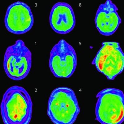 Washington University in St. Louis. Associate Professor in Neurology, specialize in Epilepsy and EEG with Focus in Machine Learning and Data Science