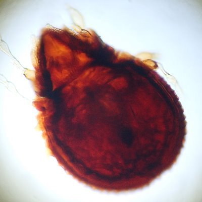 ただのダニ好き高校生 ヒゼンダニが角質層に潜り込むことによって生じる 猛烈なかゆみを伴う病気 重症化したものはノルウェー疥癬とも呼ばれる 大村智さんのノーベル賞受賞は疥癬治療薬イベルメクチン 確か の開発による ただのダニ好き高校生 ヒゼンダニが角質層に潜り込むことによって生じる 猛烈なかゆみを伴う病気 重症化したものはノルウェー疥癬とも呼ばれる 大村智さんのノーベル賞受賞は疥癬治療薬イベルメクチン 確か の開発による