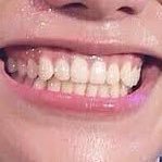 🦷ゆちゃ殿🦷固ツイ見てね👀さんのプロフィール画像