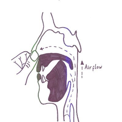 Cleft Palate&Craniofacial SLT CEN, UK. SLTs working in cleft centres, as link&community SLTS with a special interest in Cleft & Cranio speech. Views our own