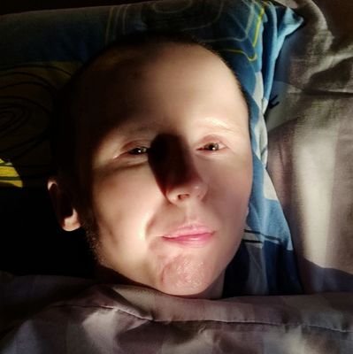 Choruję na Kostniejące Zapalenie Mięśni - Myositis Ossificans Progressiva (FOP). Jest to choroba:
*postępująca,
*nieuleczalna,
*w ciągłym bólu