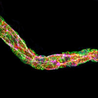 Jaap van Buul's lab uses advanced microscopy to visualise the orchestrating role of the endothelium during leukocyte transendothelial migration.