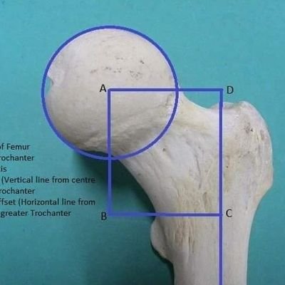 drb_anand's profile picture. Proud Indian,orthopaedic surgeon, Researcher, Fitness, politics,  #MINDTICKLER.