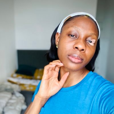 Lover of God, family and good music. RGN 🇳🇬🇬🇧. Currently a Pain Nurse Practitioner making impact one day at a time. YouTuber… please follow my account 👇