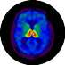 UMich Nuclear Medicine (@nuclmed) Twitter profile photo UMich Nuclear Medicine (@nuclmed) Twitter profile photo