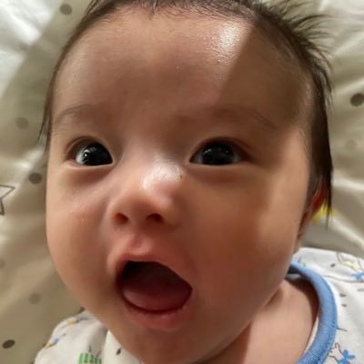 じゅん Pa Twitter 原因不明の全身湿疹できてくそかゆいし 下痢でるしおれの体はどうなってんだ じゅん Pa Twitter 原因不明の全身湿疹できてくそかゆいし 下痢でるしおれの体はどうなってんだ