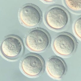 Our laboratory is investigating the molecular mechanisms of (1) meiotic cell cycle regulation, (2) establishment of meiosis-specific chromosomal structures.