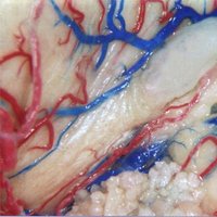 Neurosurgical Anatomy(@NeurosurgA) 's Twitter Profile Photo