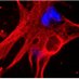 Tissue & Cell Engineering Society Conference 2021 (@tces2021) Twitter profile photo Tissue & Cell Engineering Society Conference 2021 (@tces2021) Twitter profile photo