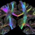 Neuroethics International Consortium (@neuroethicslab) Twitter profile photo Neuroethics International Consortium (@neuroethicslab) Twitter profile photo