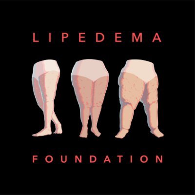 The Lipedema Foundation is not a medical provider and shares content for informational purposes. Consult a healthcare professional about medical advice.