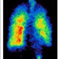 Prof. Resp Sciences @BrunelUni @BrunelSTAHR | research | smart tech & health | lungs | imaging. Research and ACP. Ed @ijapractice. Gov @healthsciuni