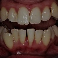 дикий дед🦇 wwdits фаза (@beetlegreedtter) 's Twitter Profile Photo дикий дед🦇 wwdits фаза (@beetlegreedtter) 's Twitter Profile Photo