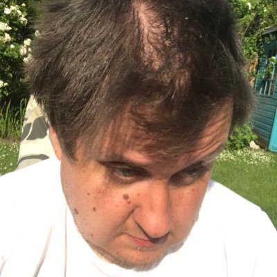 41 years of age; optimist, have many and varied hobbies and use other social networks such as #Facebook , So just ask away; Plus, blind/ND language enthusiast