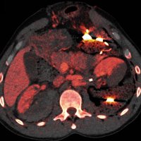VGH Emergency and Trauma Radiology (@vghemergrad) 's Twitter Profile