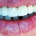 Lectures Dentist (@lecturedentist) Twitter profile photo Lectures Dentist (@lecturedentist) Twitter profile photo