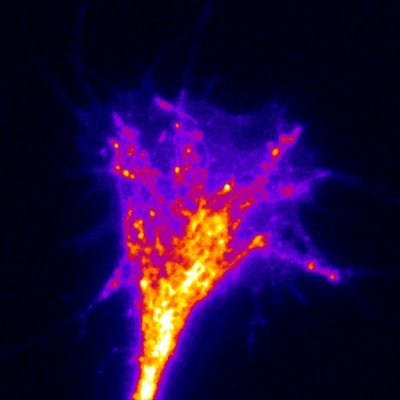 Postdoc with Vissel lab @ St Vincent's AMR
Interested in neurobiology, RNA editing, synaptic function, Ca2+ signalling, live-cell and super-res imaging