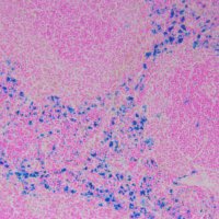 IRONY (Iron and Immunity Lab) (@peyssonnaux_lab) 's Twitter Profile
