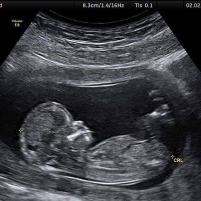 Kh15480725's profile picture. دع مايريبك