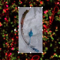 ESGB (@esgb_escmid) 's Twitter Profile Photo ESGB (@esgb_escmid) 's Twitter Profile Photo