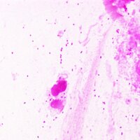 G剛O (グラム染色道場主:Gram Stain Gym Instructer) (@ugougoy) 's Twitter Profile Photo G剛O (グラム染色道場主:Gram Stain Gym Instructer) (@ugougoy) 's Twitter Profile Photo
