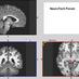 NeuroTech Forum (@neurotechforum) Twitter profile photo