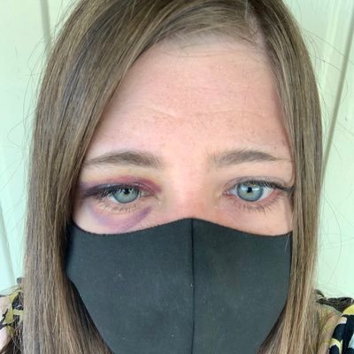 IStanBravo1's profile picture. Mainly Bravo & Celtic FC