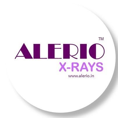 ALERIO X RAYS