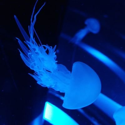 先天性心疾患(心内膜床欠損症→僧帽弁閉鎖不全症)/開胸手術3回(胸骨正中切開/傷あり)/僧帽弁形成術/2019年、僧帽弁置換術・三尖弁形成術/30代♀/慢性心不全/不整脈(心房)持ち/カテーテルアブレーション済
日常生活では手術の傷は隠しています。幼少期の心臓治療の影響で医療行為へのPTSDがあります。治療記録ブログ⇩