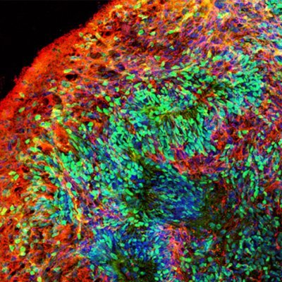 Lab @RutgersSASDLS. Develop human #iPSC brain #organoid & human-mouse #chimeric brain to study #neurodevelopment, #aging,  #DownSyndrome, #Alzheimers, & #Autism