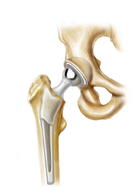 Information related to Biotribology