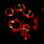 Assoc. Prof. @USUhealthsci. Bacteriologist. #Chlamydia enthusiast. Reviewer #3. https://t.co/MYnjoG3k9g Opinions are mine.