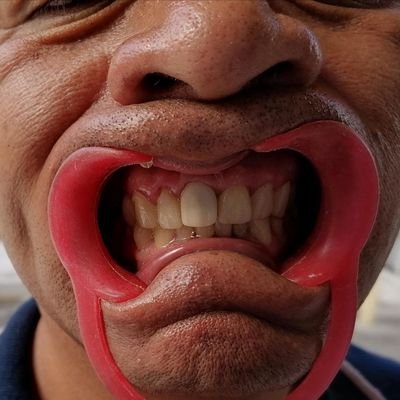 Protesista dental en edo.mex